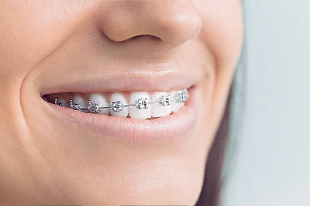 Best Traditional Braces  in Hampton, GA